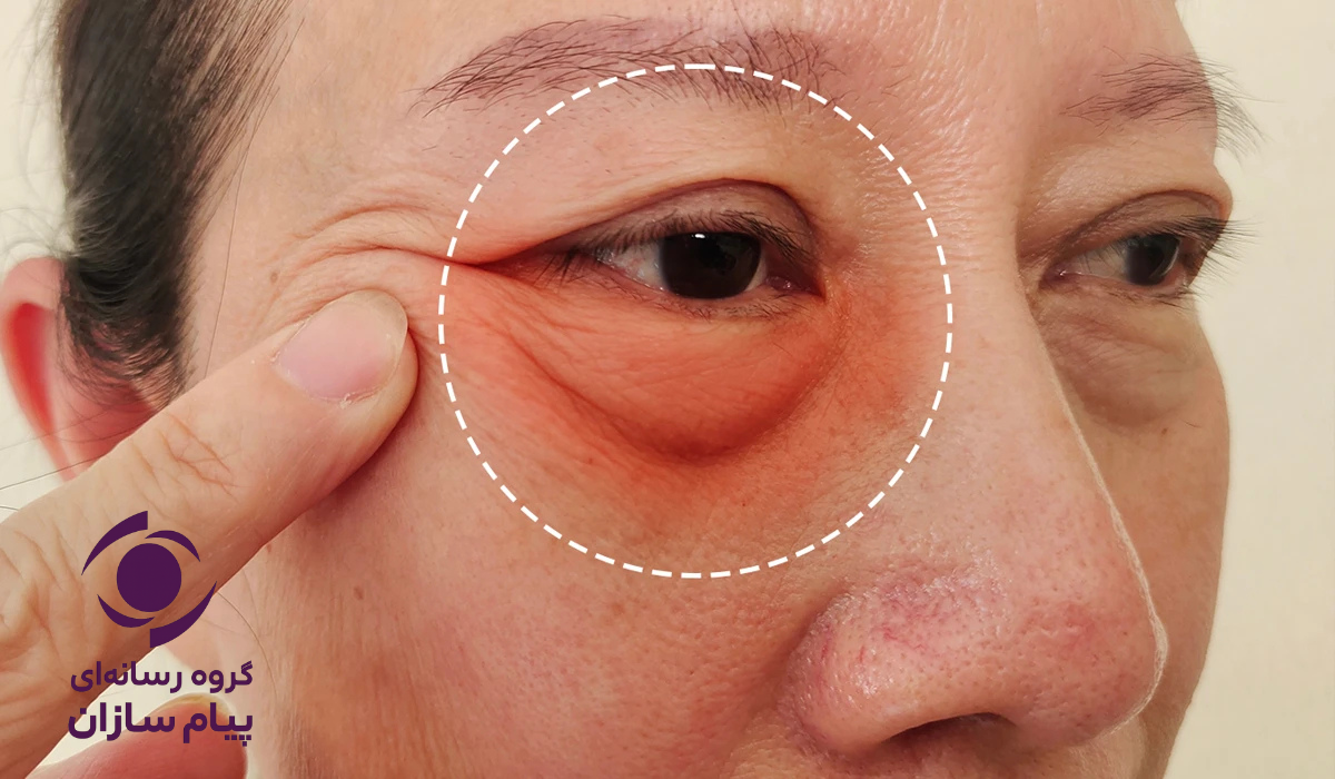 عوارض در کلینیک های زیبایی