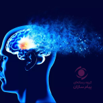 آلزایمر- دمانس