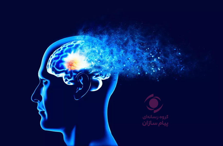 آلزایمر- دمانس